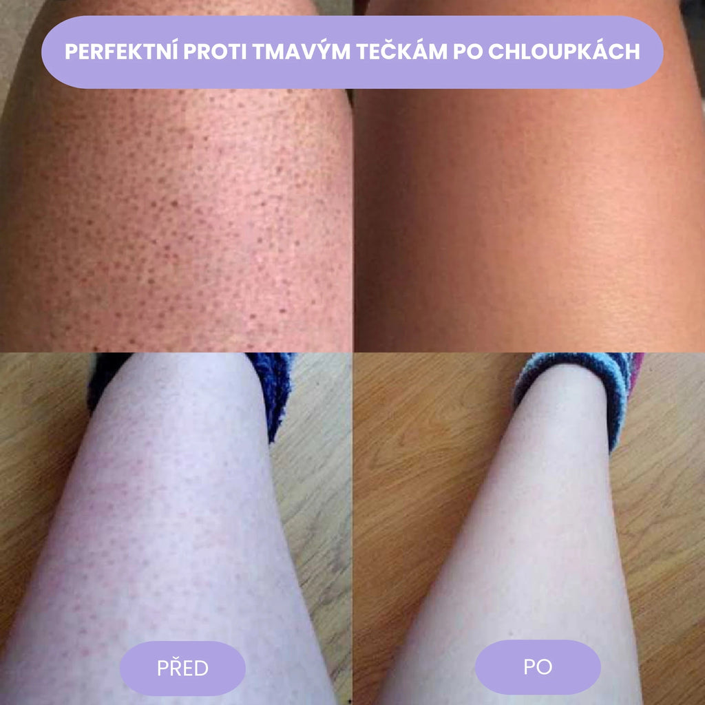 Vesta Crystal Hair Eraser